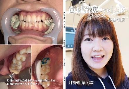 歯科治療　Vol.18