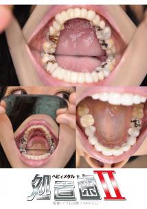 処置歯2 　-ヘビィメタル-　　9人