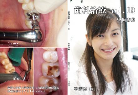 歯科治療　Vol.19