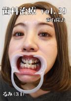 歯科治療　Vol.29