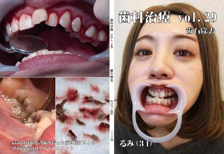 歯科治療　Vol.29