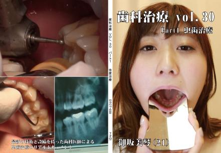 歯科治療　Vol.30 Part1