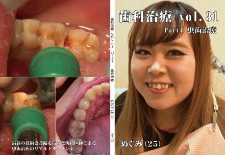 歯科治療　Vol.31 Part1