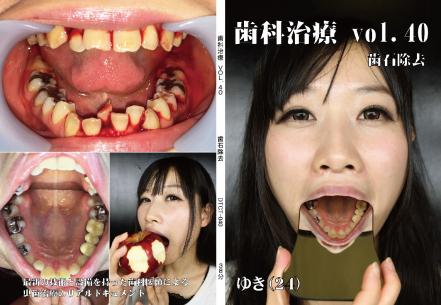 歯科治療　vol.40