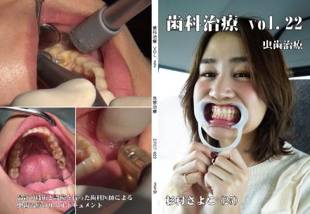歯科治療　Vol.22