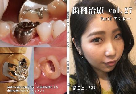 歯科治療　Vol.27　Part2