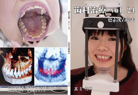 歯科治療　Vol.24