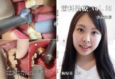 歯科治療　Vol.25