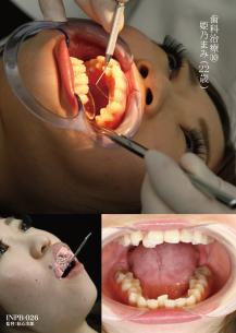 歯科治療10　姫野まみ