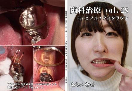 歯科治療　Vol.28　Part2