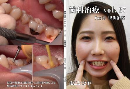 歯科治療　Vol.27　Part3
