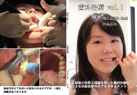 歯科治療　Vol,1