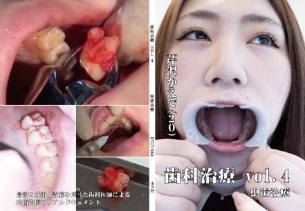 歯科治療　Vol,4