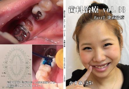 歯科治療　Vol.33　Part2