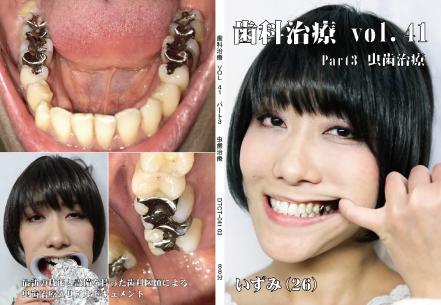 歯科治療　vol.41　part3