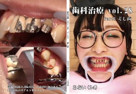 歯科治療 vol.28 part3