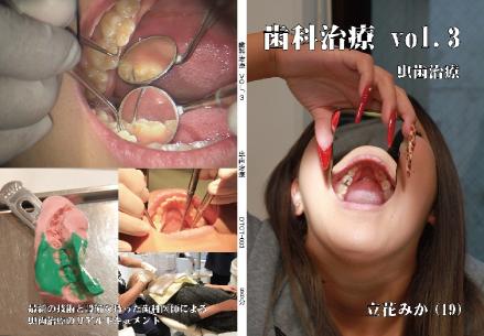 歯科治療　Vol,3
