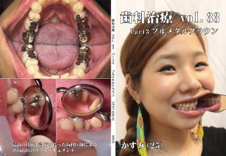 歯科治療　Vol.33　Part3