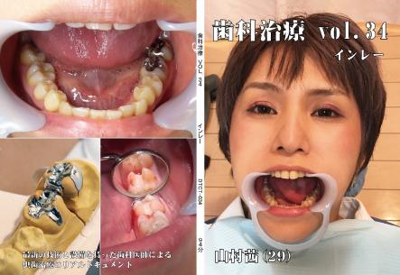 歯科治療　Vol.34