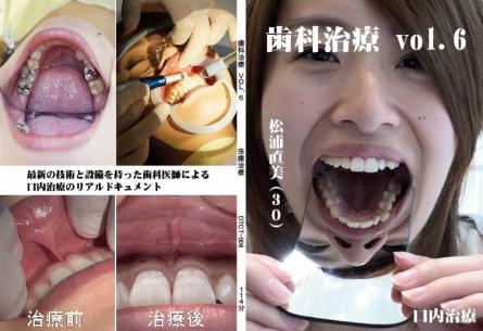 歯科治療　Vol,6