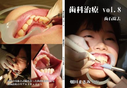 歯科治療　Vol,8