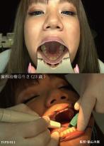 歯科治療⑤　りさ