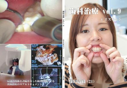 歯科治療　Vol,9