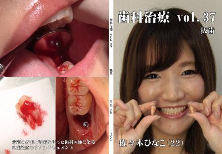 歯科治療　Vol.37