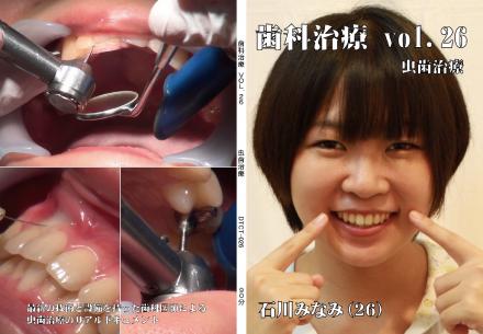 歯科治療　Vol.26