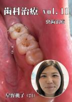 歯科治療　Vol,11