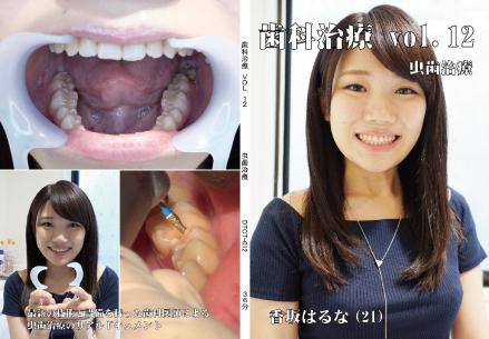 歯科治療　Vol,12