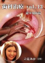 歯科治療　Vol,13