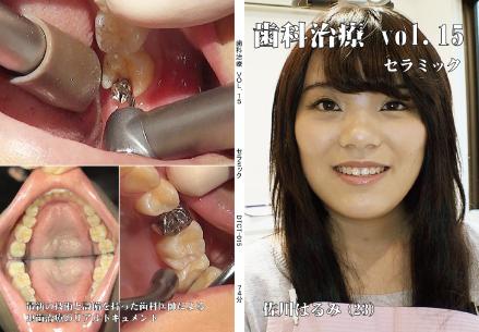 歯科治療　Vol,15