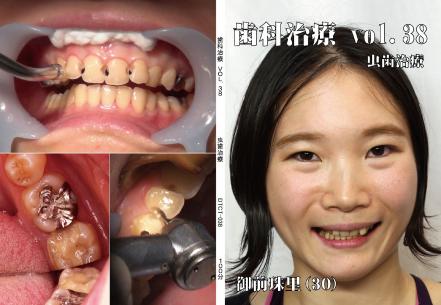 歯科治療　vol.38