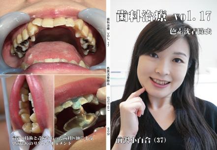 歯科治療　Vol,17
