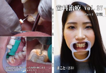 歯科治療　Vol.27　Part1
